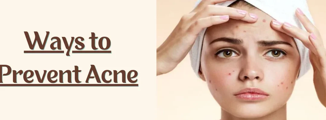 10 Best Ways to Prevent Acne