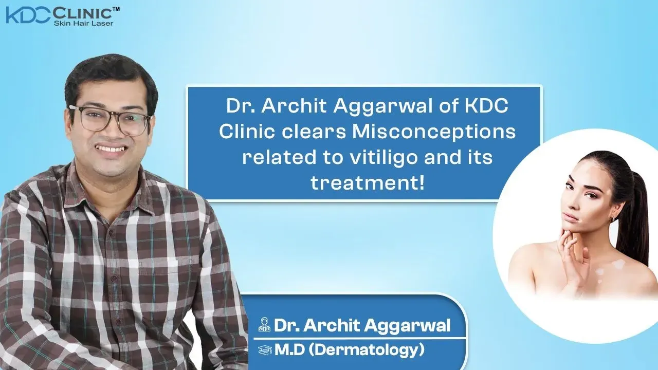 Dr. Archit Aggarwal of KDC Clinic clears Misconceptions related to vitiligo and its treatment!