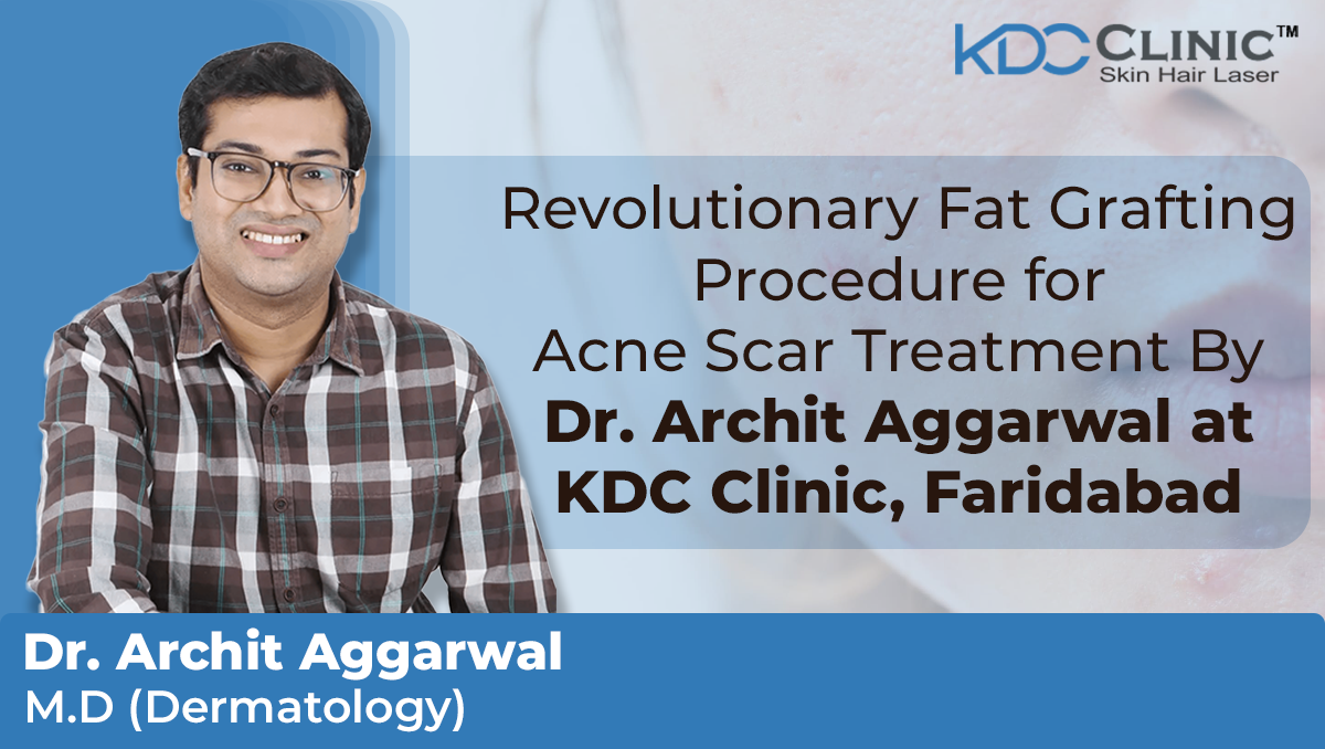 Dr. Archit Agarwal Of KDC Clinic Faridabad Revolutionizes Acne Scar Treatment With Innovative Fat Grafting Procedure