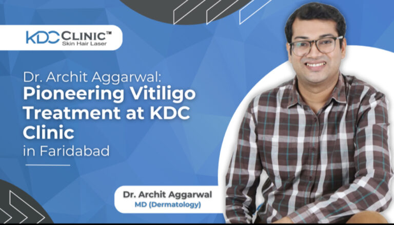 Dr. Archit Aggarwal: Pioneering Vitiligo Treatment at KDC Clinic in Faridabad