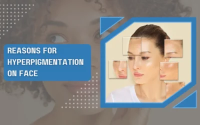 Reasons For Hyperpigmentation On Face